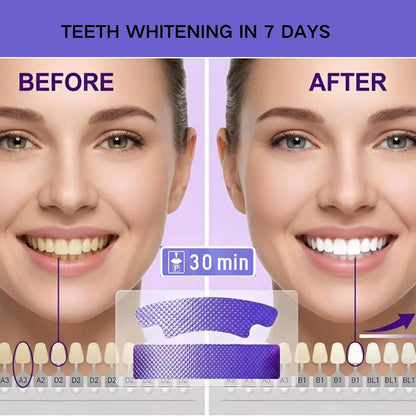 LumiDentt Purple Instant Whitening Strips